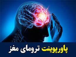 پاورپوینت ترومای مغزی